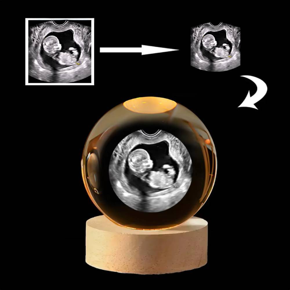 Customized B-Ultrasound Photo 3D Crystal Ball Hold Baby's First Ultrasound Memories - MyMoonLampAu