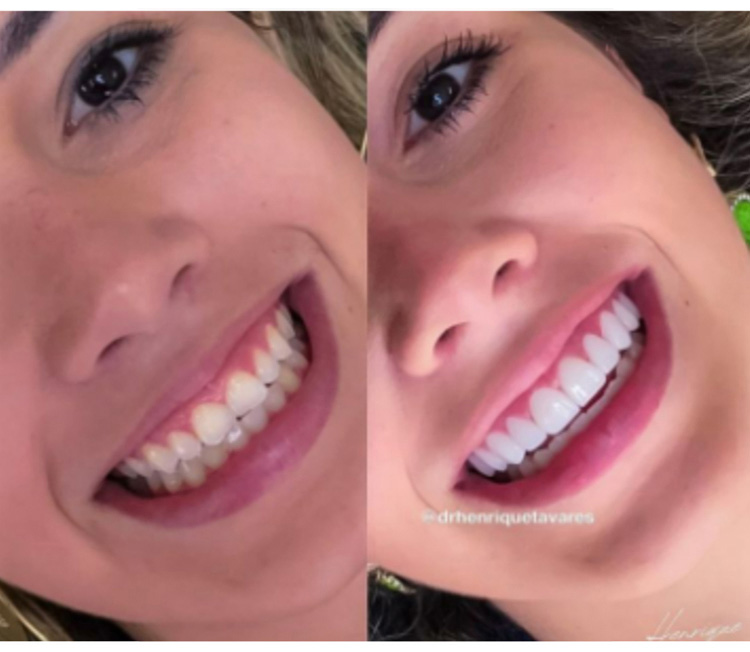 1728891829452497_22.jpg