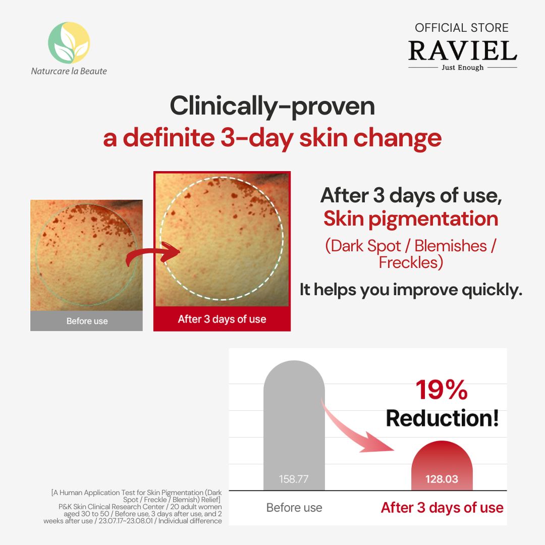 Raviel Acerola Dark Spot & Blemish Care Cream 50ml | Fades dark spots & acne scars, brightens and repairs skin