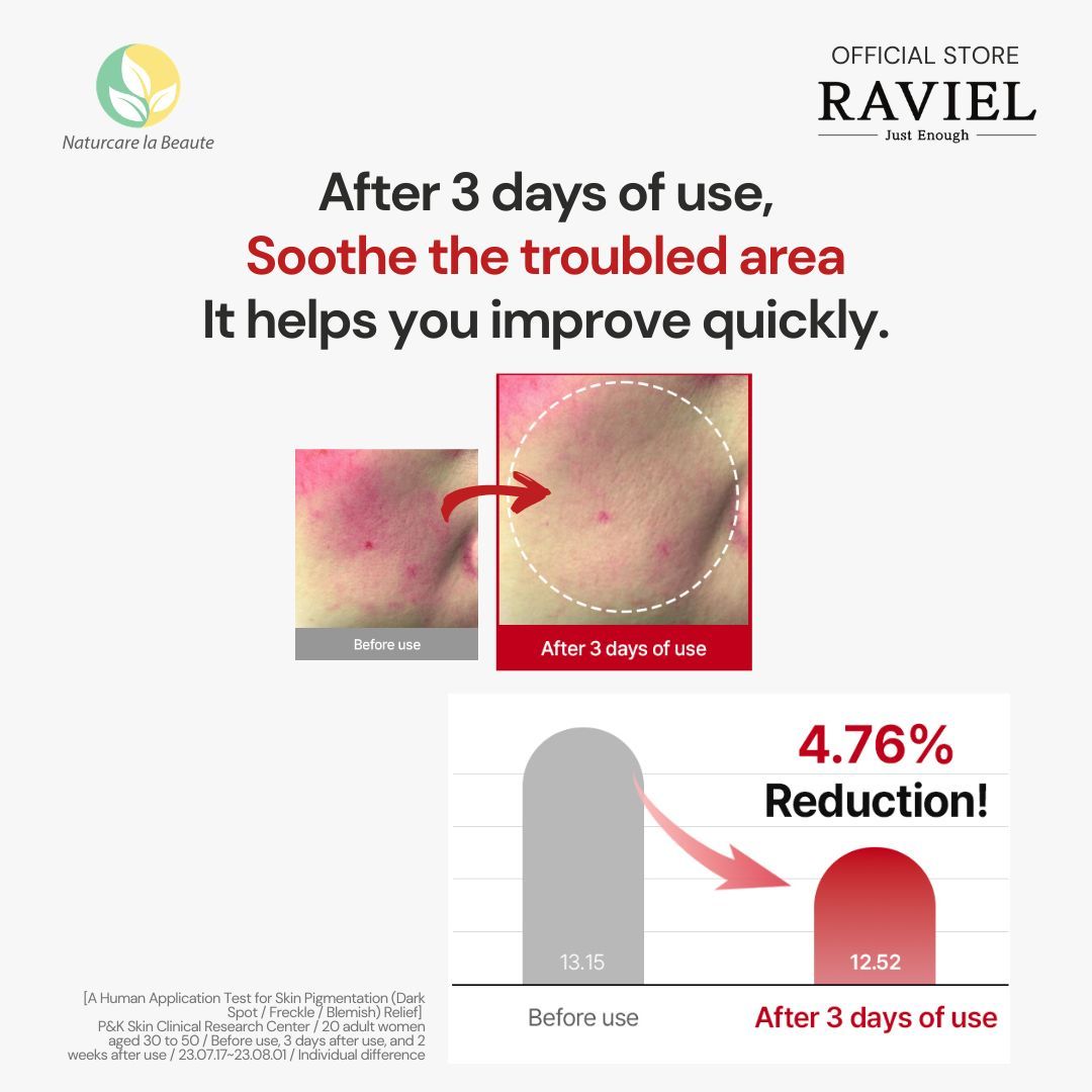 Raviel Acerola Dark Spot & Blemish Care Cream 50ml | Fades dark spots & acne scars, brightens and repairs skin