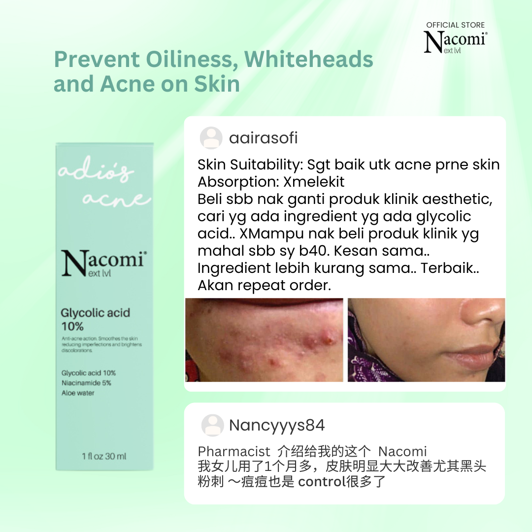 Nacomi Next Level Glycolic Acid 10% Face Serum - Reduces Pimples & Skin Refining