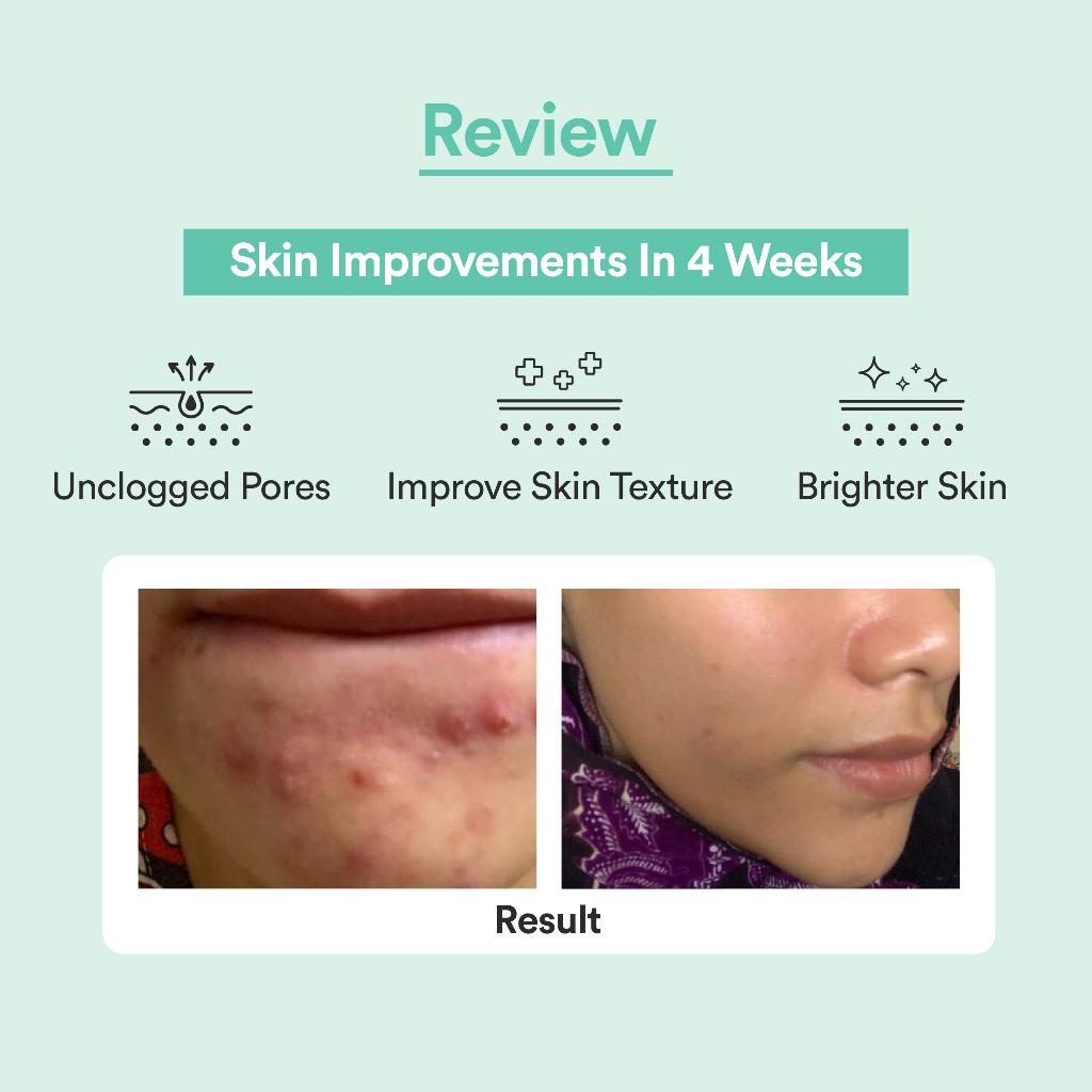 Nacomi Next Level Glycolic Acid 10% Special Bargains