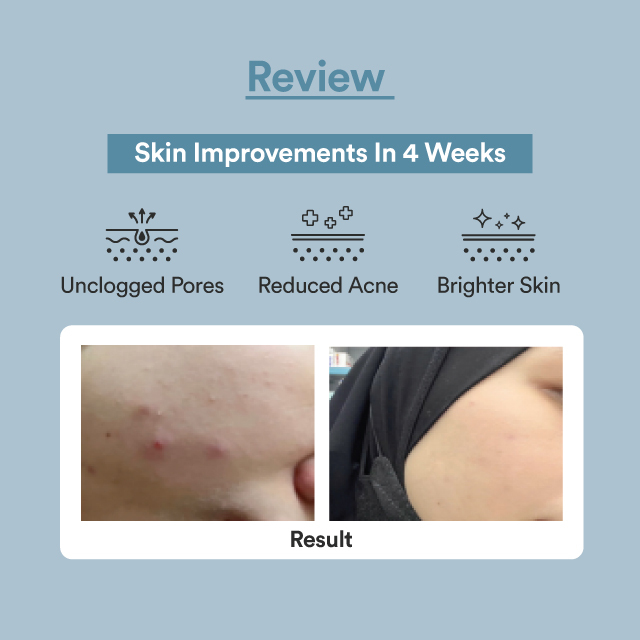 Nacomi Next Level Niacinamide 15% Face Serum (Special Bargains)