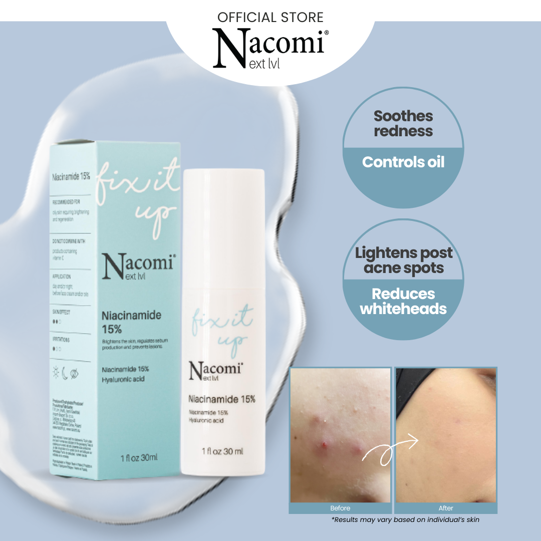 Nacomi Next Level Niacinamide 15% Face Serum - Oil Control, Tightens Pores & Brightens Skin