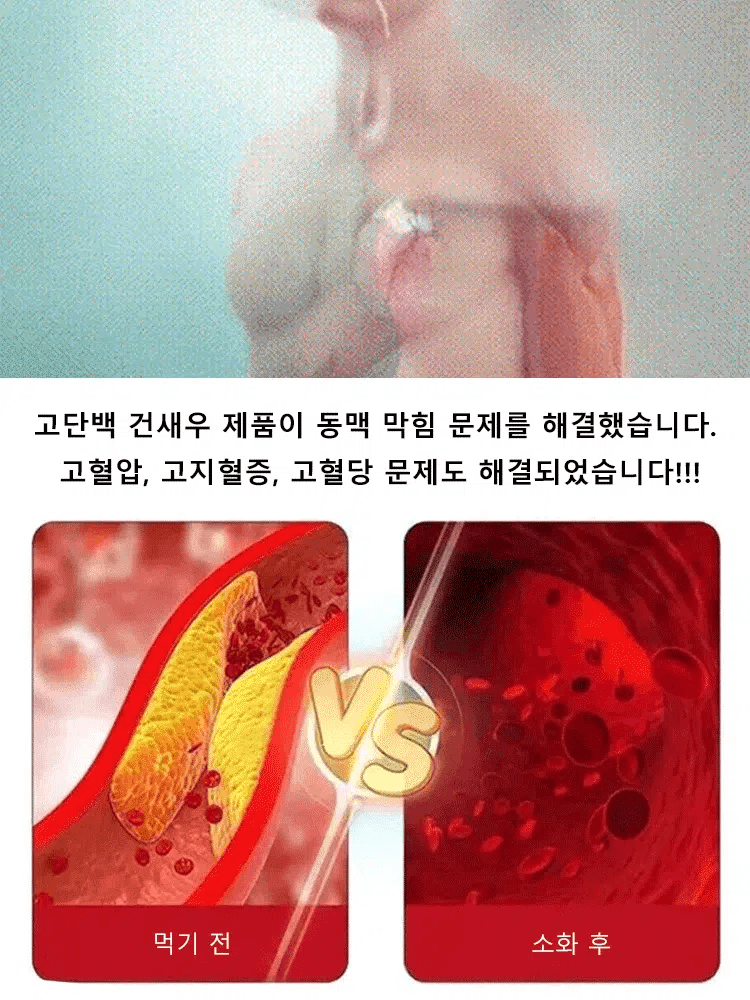 킹크랩 통다리살