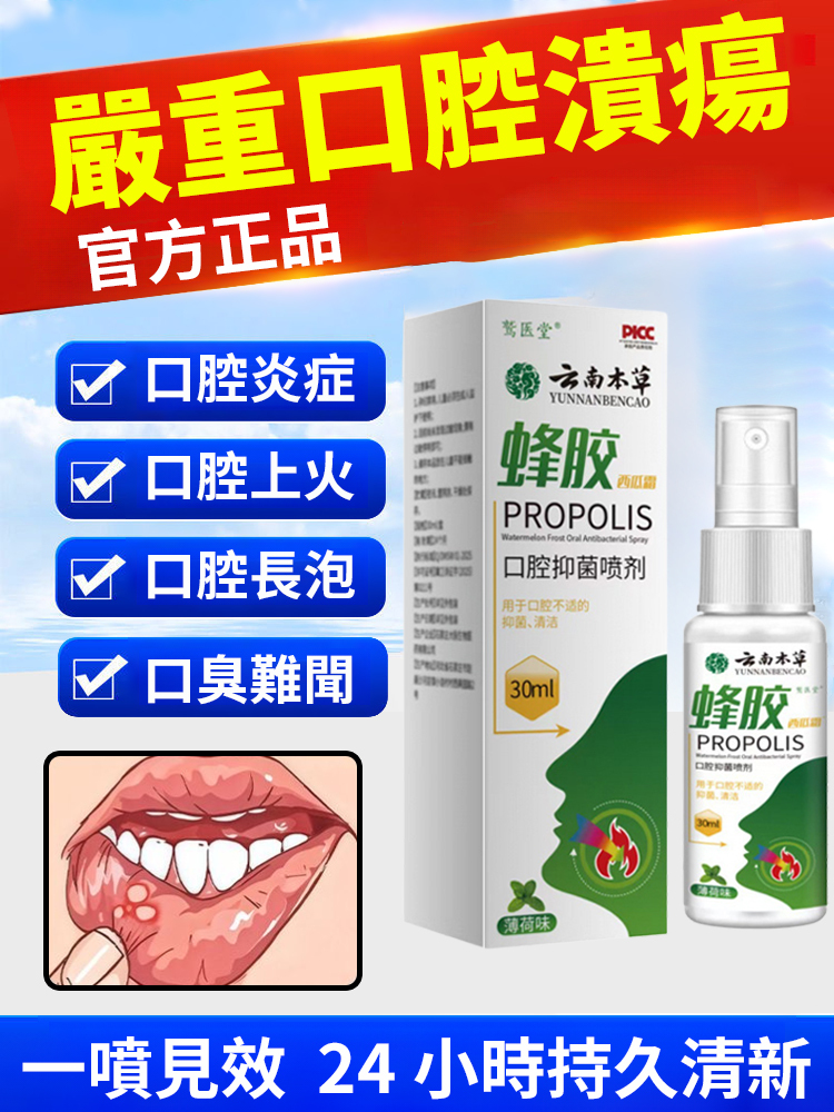 蜂膠口抑菌噴劑