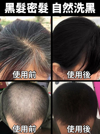 冬蟲夏草控油洗髮精