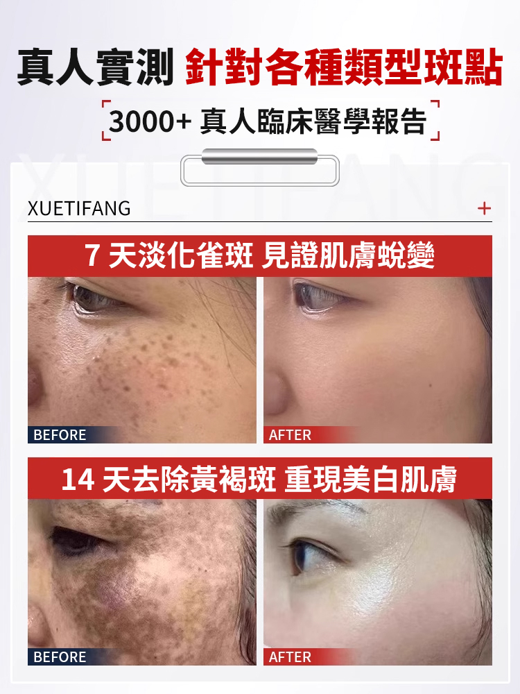 強效美白祛斑霜
