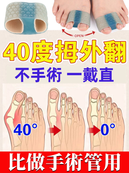 拇指外翻大腳骨雙趾分離器