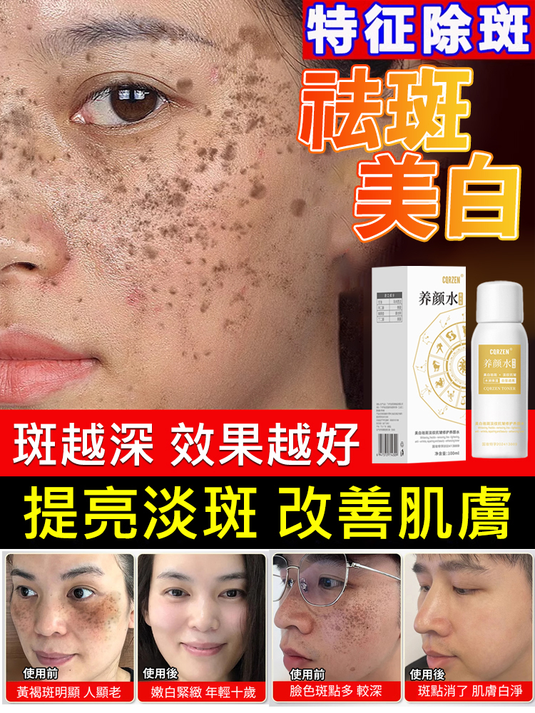 祛斑美白養顏水