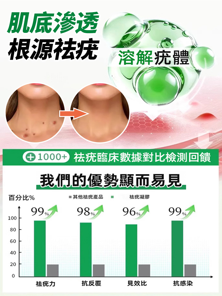 祛疣護理乳膏