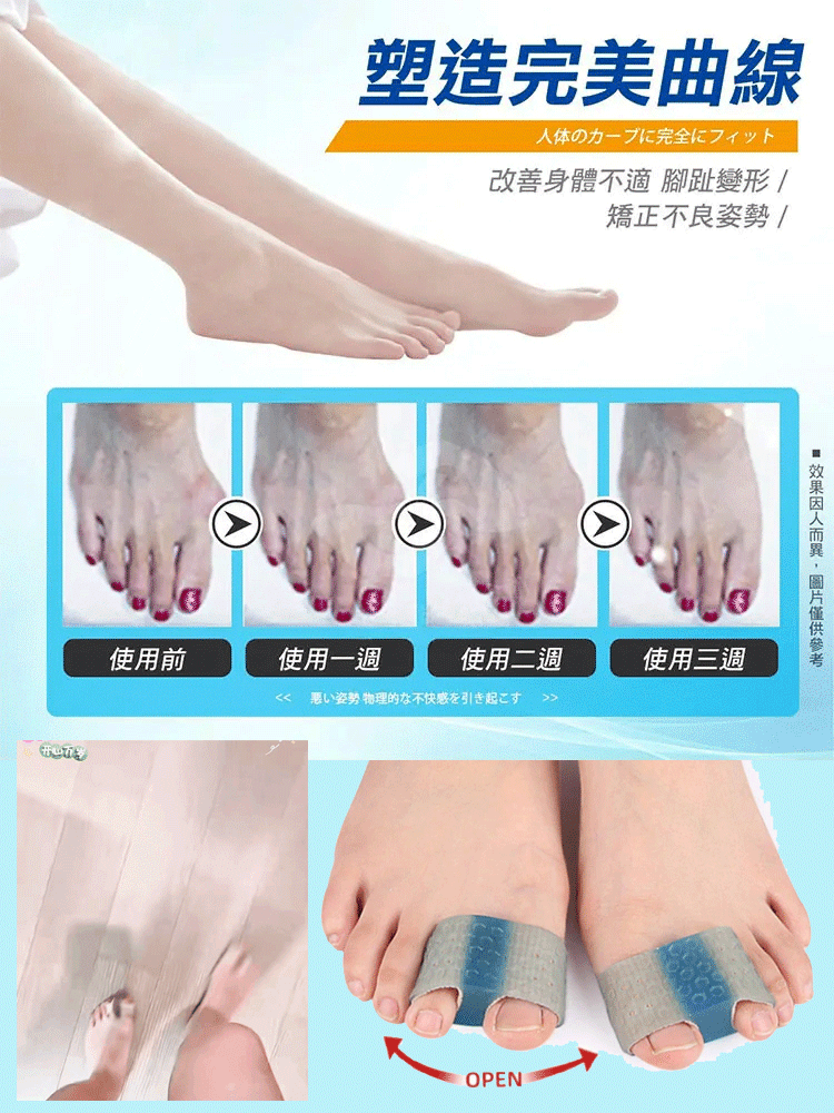 拇指外翻大腳骨雙趾分離器