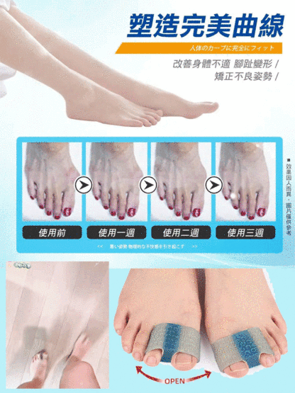 拇指外翻大腳骨雙趾分離器
