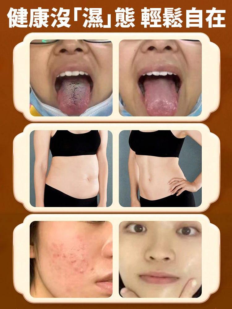 草本黃耆苓固本顆粒