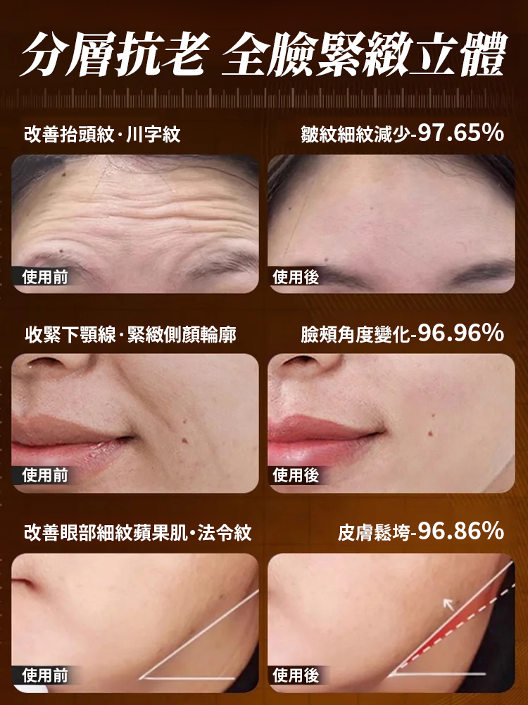 【皺紋一抹消】山參膠原抗皺乳霜