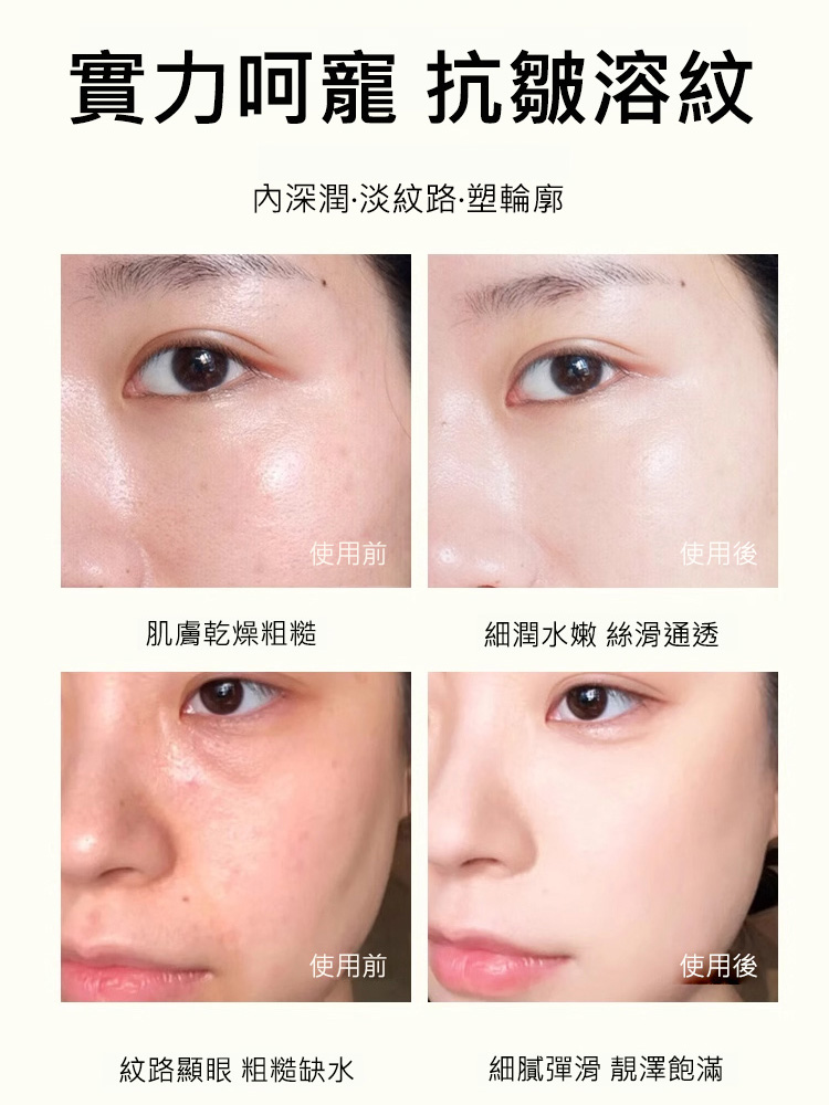 膠原倉撫紋填充酵母蛋白精華液