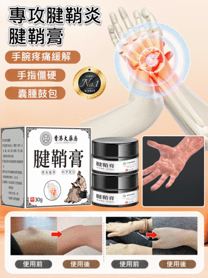 香港大藥局腱鞘膏