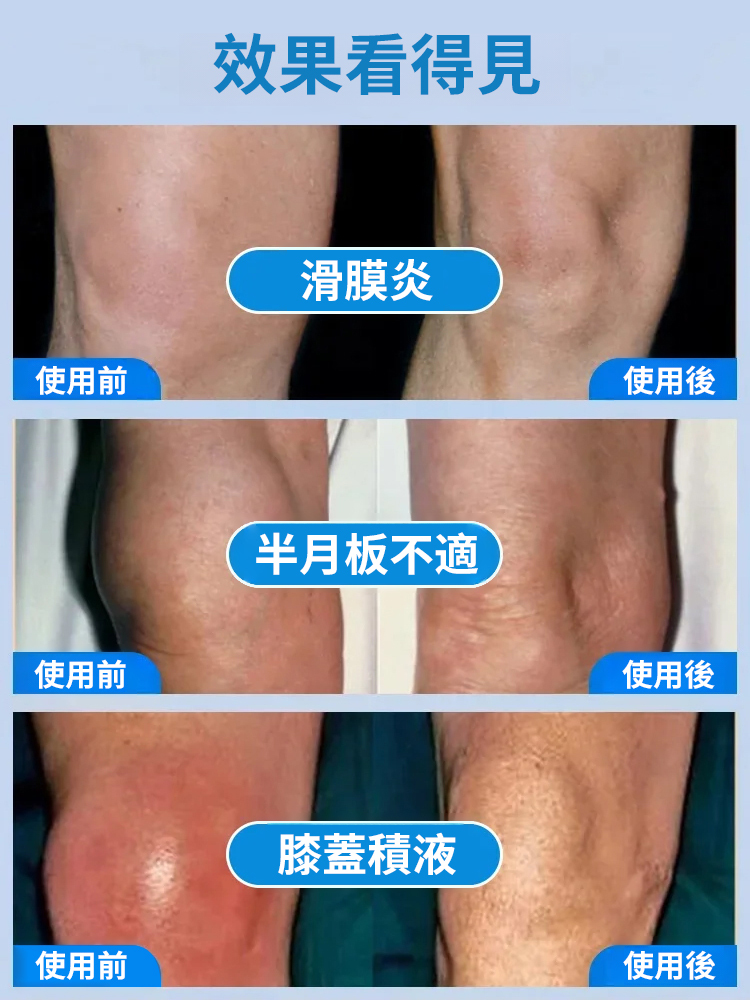 塗抹氨糖按摩膏軟骨素凝膠