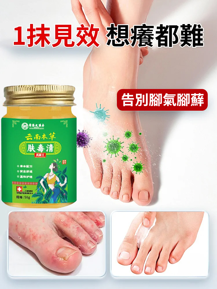 足部抑菌膏