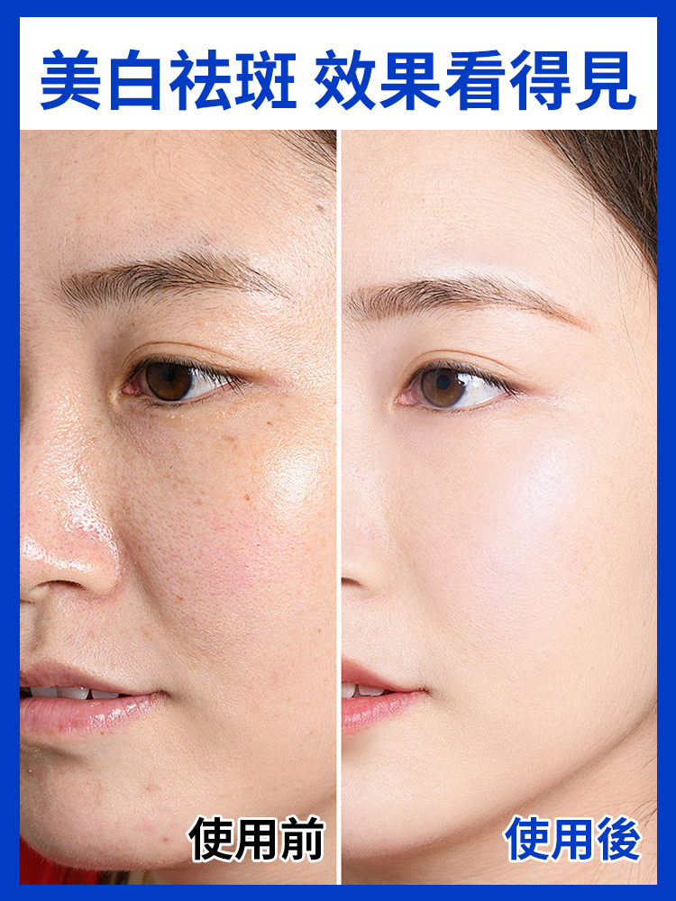 美白祛斑潔面乳