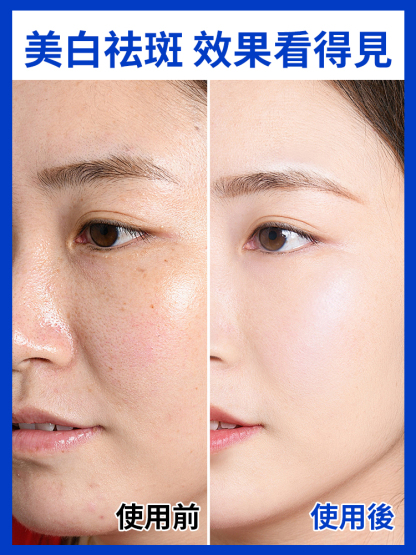 美白祛斑潔面乳