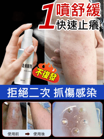 雙黃止癢噴劑