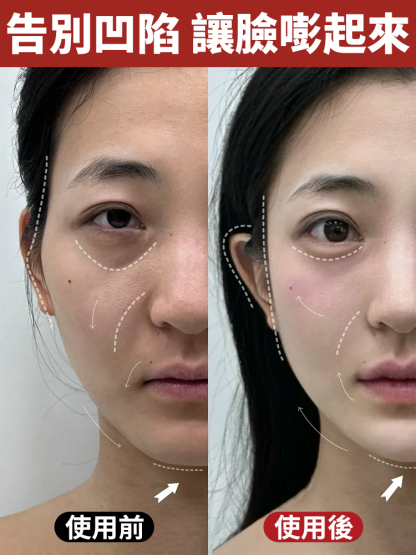 抗皺蛋白溶性緊緻套盒