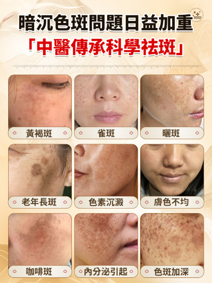 美白強效祛斑霜濃縮版