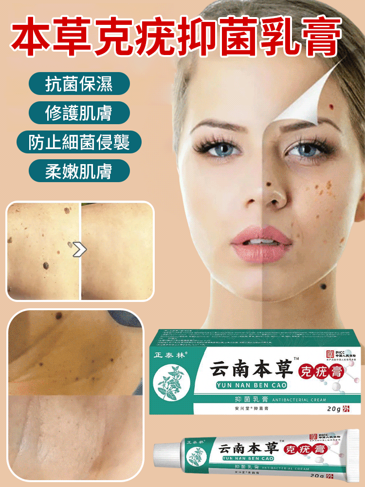 克疣膏抑菌乳膏