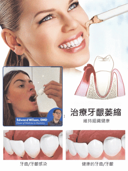 牙齒再生護理滴劑