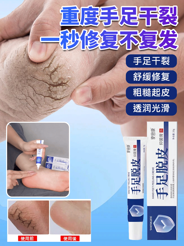 【一抹光滑】手足脫皮抑菌膏