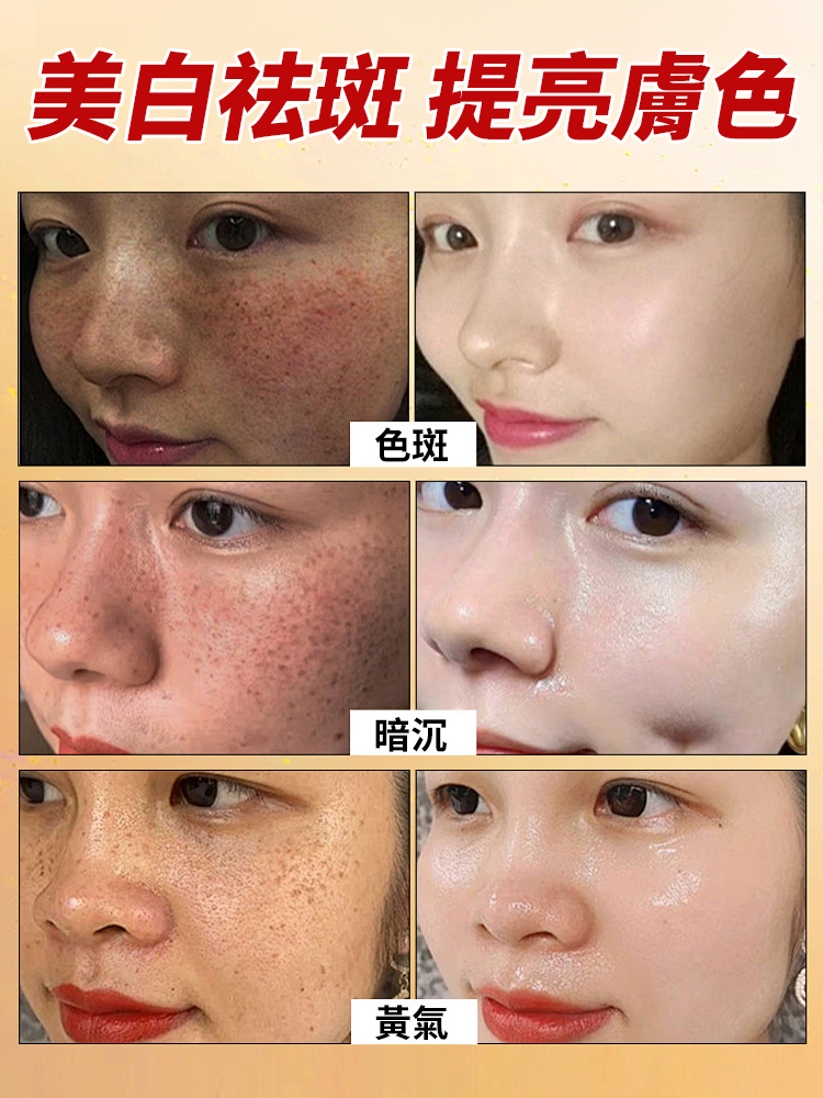 美白祛斑霜