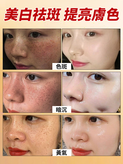 美白祛斑霜