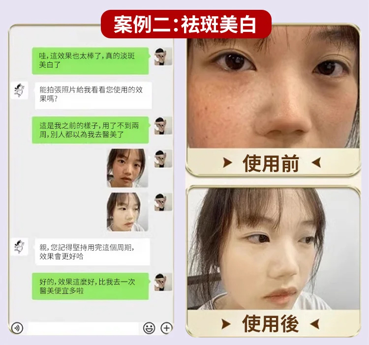 翻译件-JS-【3天变白，七天祛斑】草本美白祛斑霜-1228602-系统_16.jpg