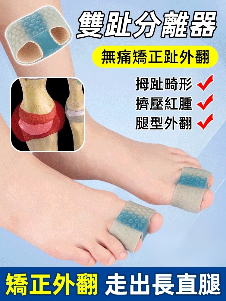拇指外翻大腳骨雙趾分離器