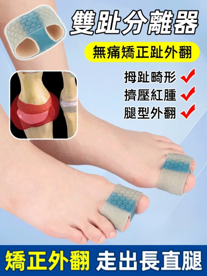 拇指外翻大腳骨雙趾分離器