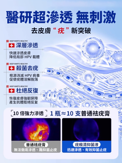妙古方疣瘊清抑菌液