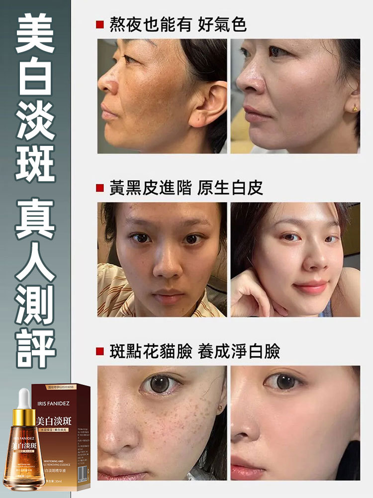 美白淡斑精華液