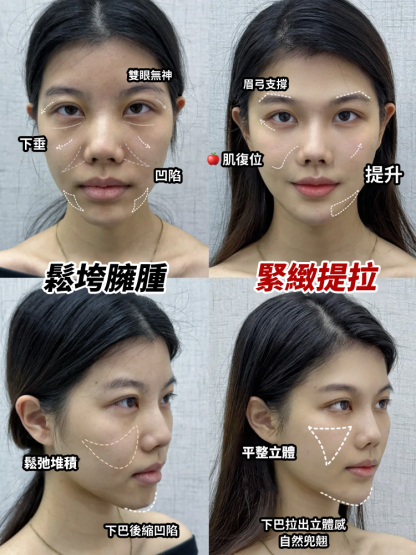 【皺紋一抹消】山參膠原抗皺乳霜