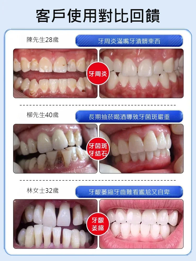 旱蓮骨碎護齦噴劑