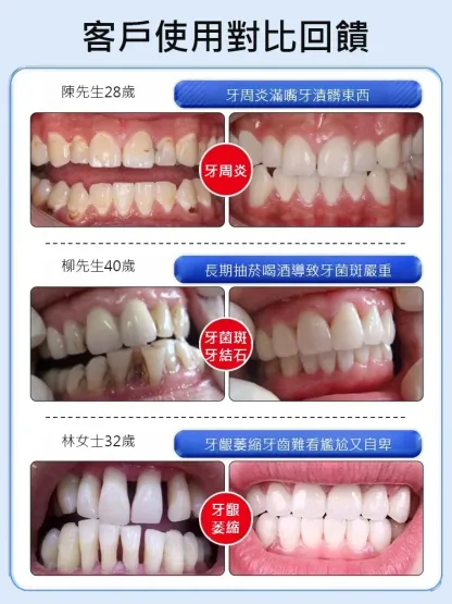 旱蓮骨碎護齦噴劑