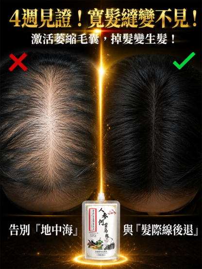 生薑防脫育髮洗髮精