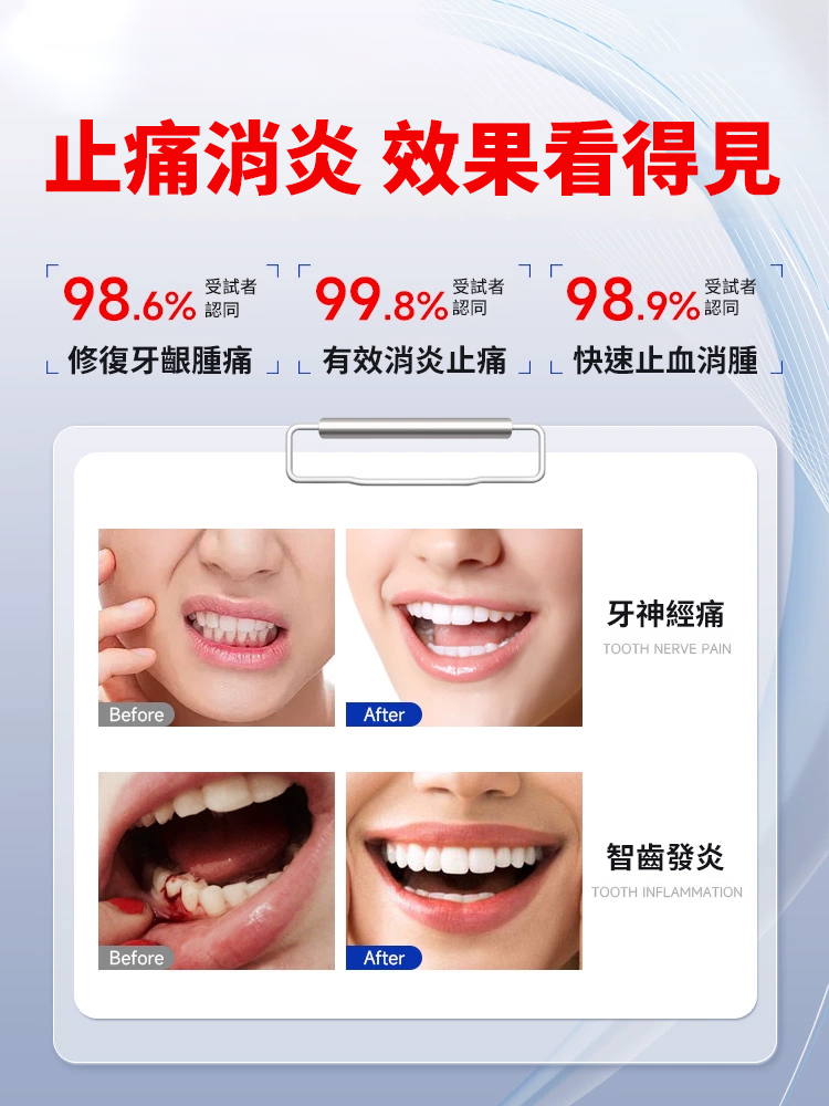 槲皮素口腔抑菌液