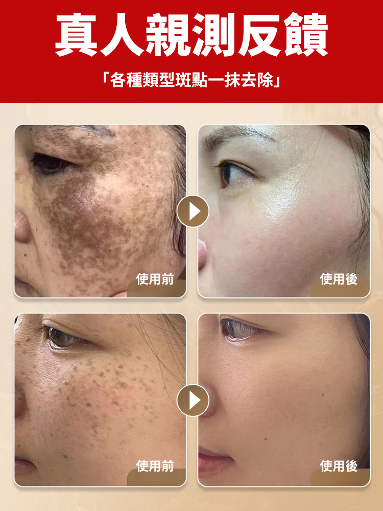 美白祛斑精華霜
