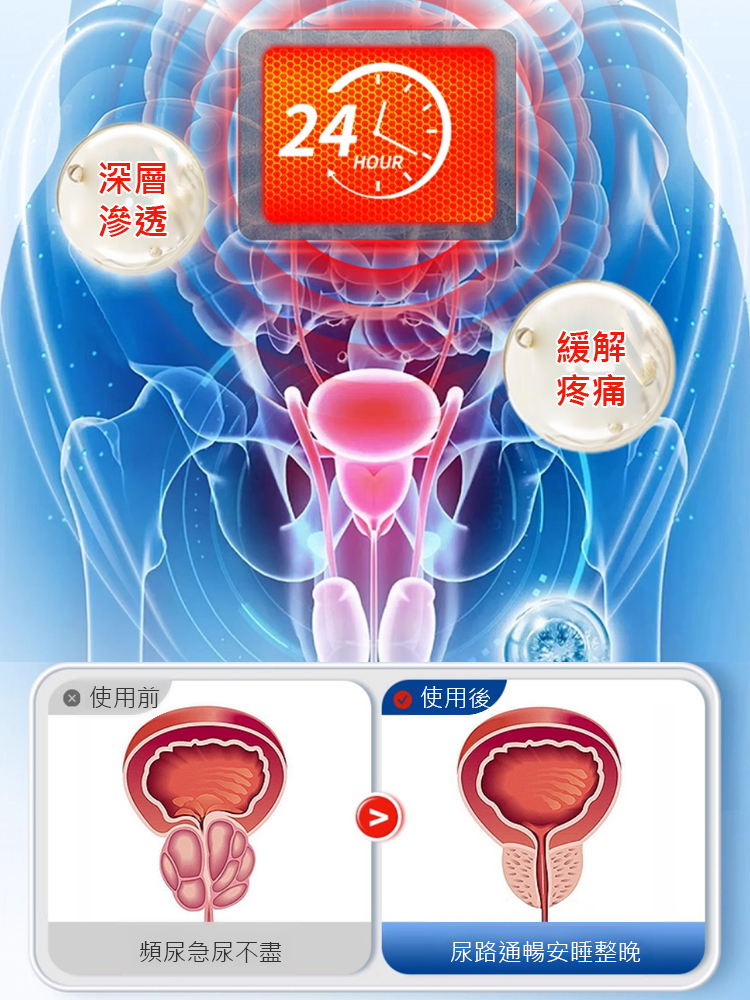 溫和草本前列腺調理穴位貼