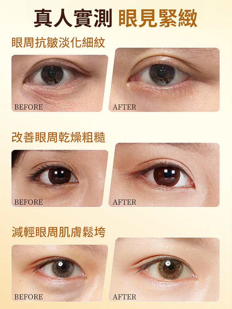 小金瓶眼部精華油