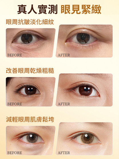 小金瓶眼部精華油
