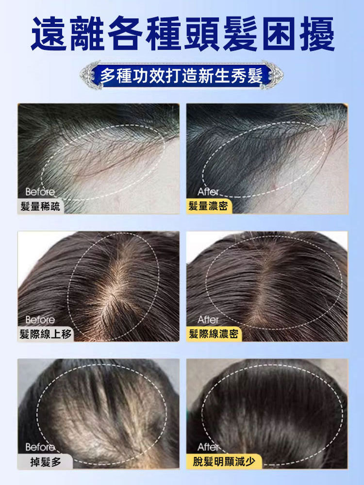 植萃毛炎寧毛囊噴霧