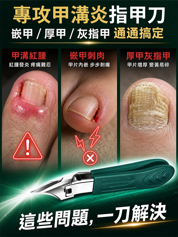 【保固十年】甲溝炎專用大開口超尖指甲刀