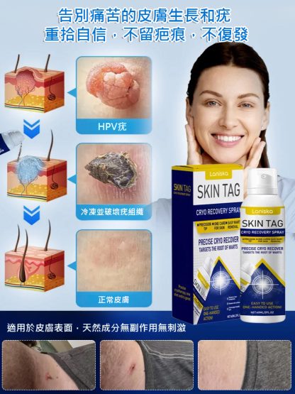 疣點外用護理噴霧